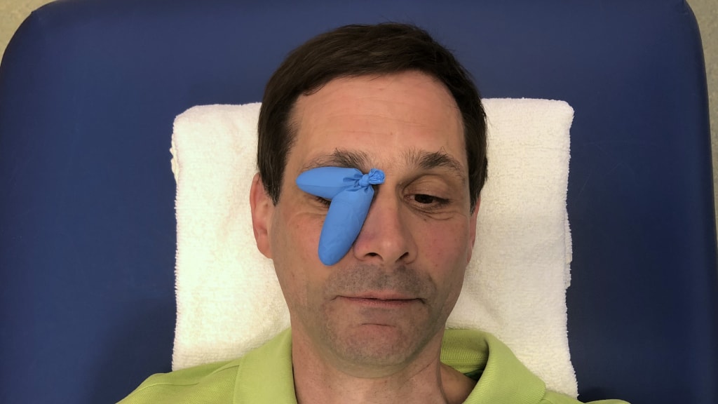 Praktisk anvendelse af et hjælpemiddel til vedvarende lukning af øjenlåg